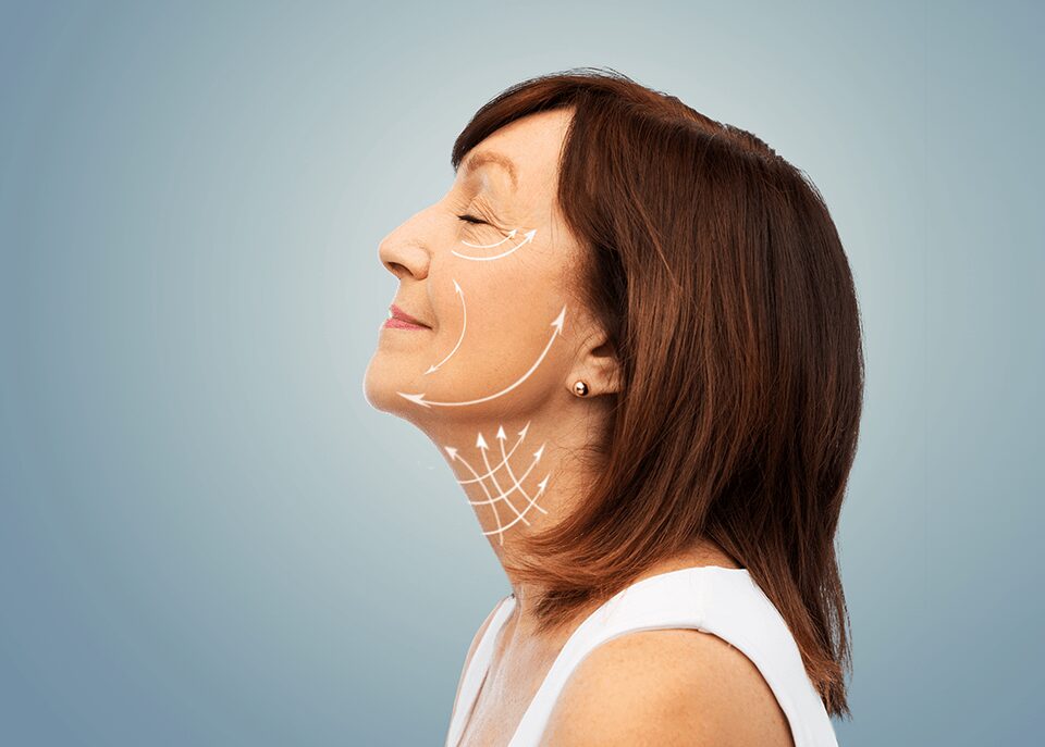 facelift-image