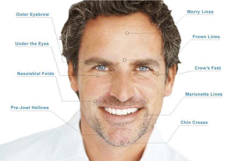 men-injectables-RFPS